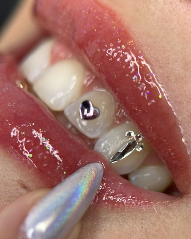 Heart and drop tooth gems by Tia Berry, Vancouver