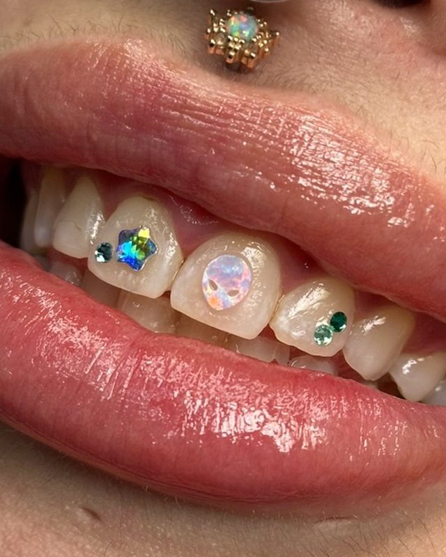 Holographic star, opal and emerald tooth gems by Tia Berry, Vancouver