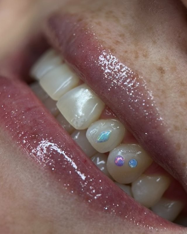 Opal and pastel crystal tooth gems by Tia Berry, Vancouver