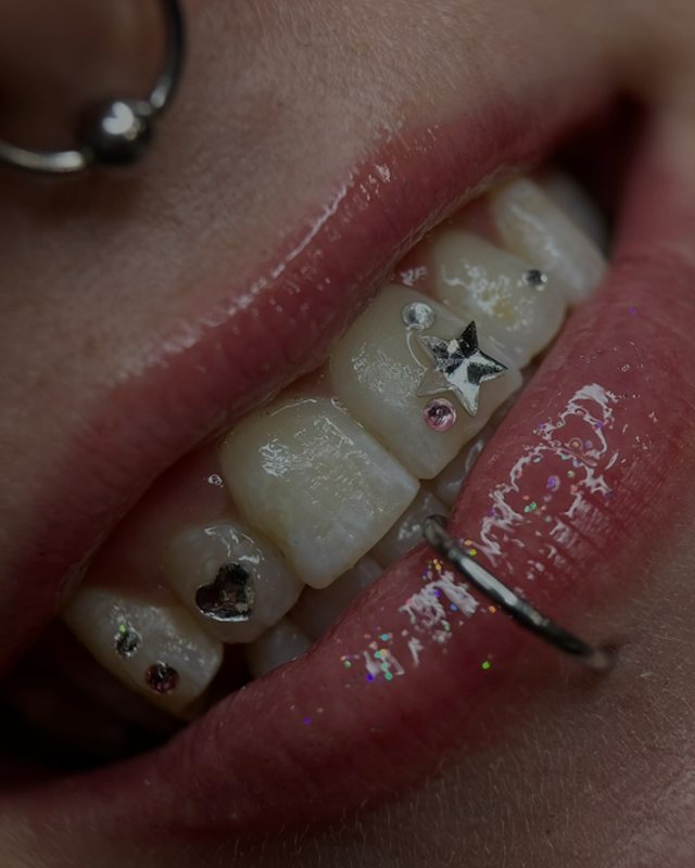 Star, heart and crystal tooth gem set by Tia Berry, Vancouver